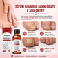 ✨ Il Regalo Perfetto per le Tue Unghie – 50% di SCONTO! ! 🌟Essenza Riparatrice che Nutre, Rinforza e Ripara le Unghie Danneggiate💅