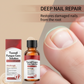 ✨ Il Regalo Perfetto per le Tue Unghie – 50% di SCONTO! ! 🌟Essenza Riparatrice che Nutre, Rinforza e Ripara le Unghie Danneggiate💅